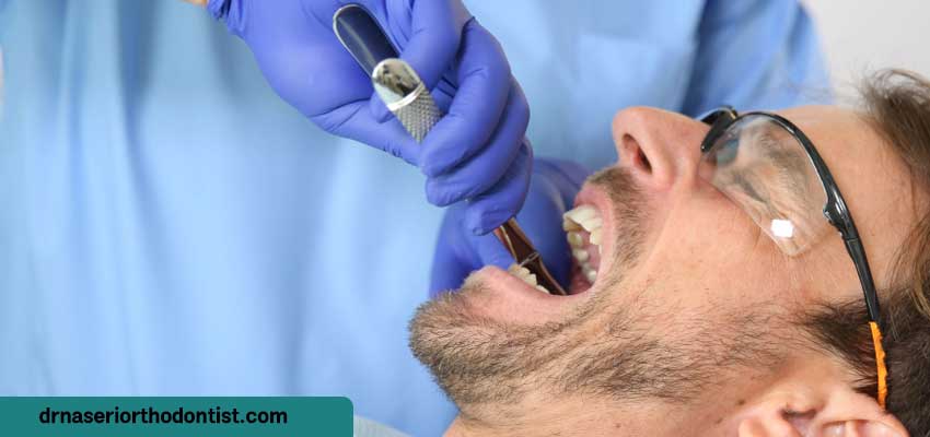 کشیدن دندان در ارتودنسی ثابت