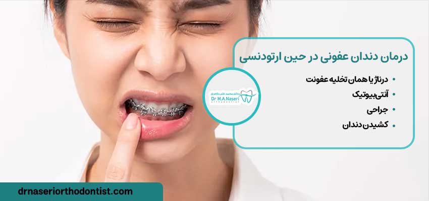 درمان دندان عفونی شده در حین ارتودنسی