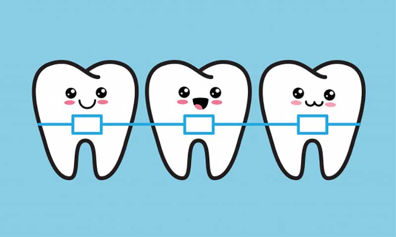 چه دندان هایی باید ارتودنسی شوند؟