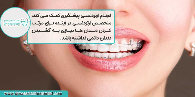 انجام ارتودنسی دیمون بدون نیاز به کشیدن دندان 