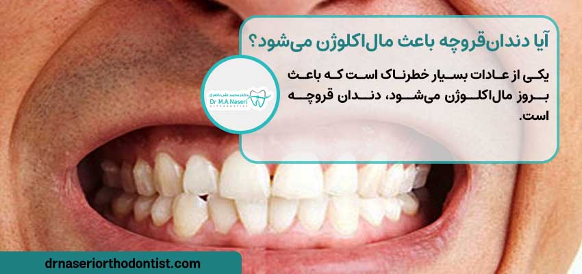آیا دندان‌قروچه باعث مال‌اکلوژن می‌شود؟ | دکتر ناصری متخصص ارتودنسی اصفهان 