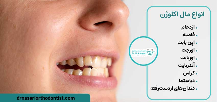 انواع حالت‌های فک و دندان | دکتر ناصری متخصص ارتودنسی اصفهان 