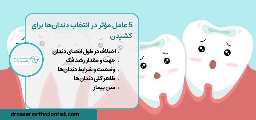 5 عامل مؤثر در انتخاب دندان‌ها برای کشیدن | دکتر ناصری متخصص ارتودنسی اصفهان 