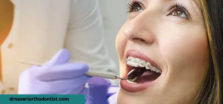 پس از چه مدت فاصله خالی ایجاد شده بین دندان‌ها بسته می‌شود؟ | دکتر ناصری متخصص ارتودنسی اصفهان 