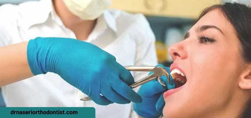 عوامل مؤثر بر کشیدن دندان در ارتودنسی | دکتر ناصری متخصص ارتودنسی اصفهان