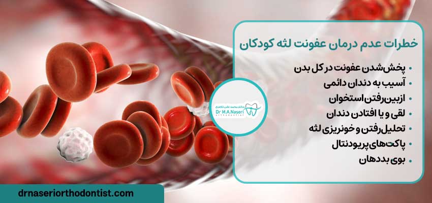 خطرات عدم درمان عفونت لثه کودکان | دکتر ناصری متخصص ارتودنسی اصفهان
