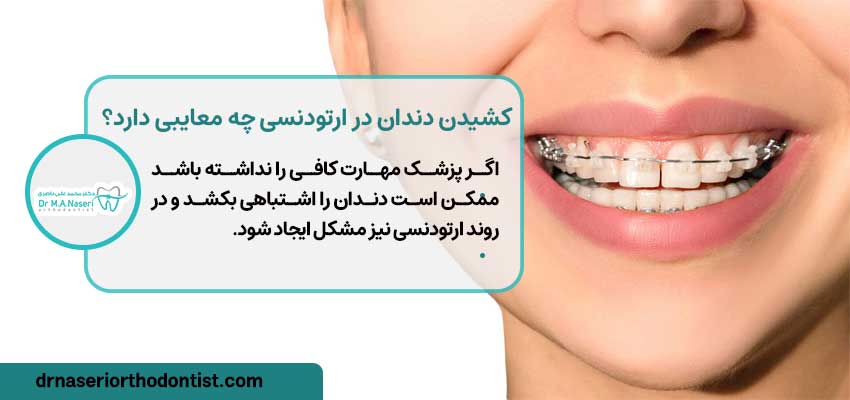 کشیدن دندان در ارتودنسی چه معایبی دارد؟ | دکتر ناصری متخصص ارتودنسی اصفهان
