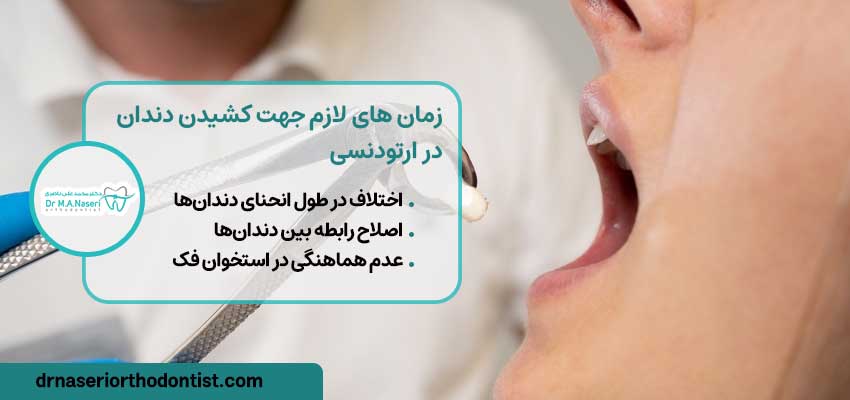 چه زمان لازم است از کشیدن دندان برای درمان ارتودنسی استفاده شود؟ | دکتر ناصری متخصص ارتودنسی اصفهان