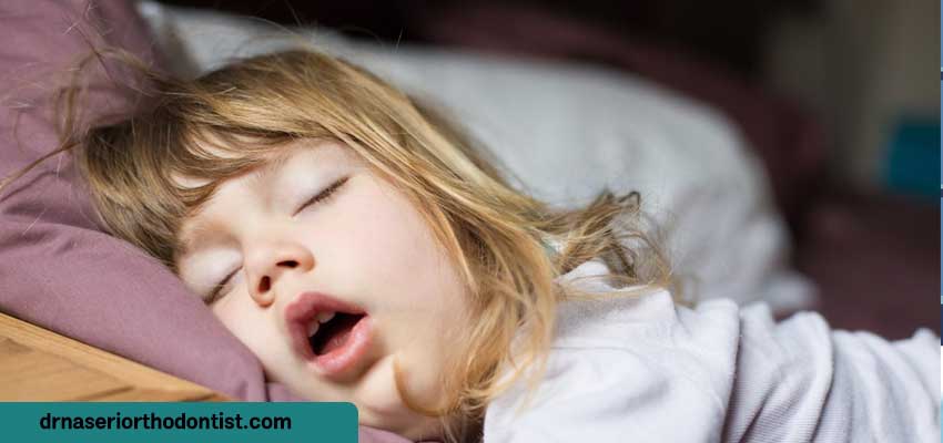 در درمان آپنه خواب کودکان با ارتودنسی چه اقداماتی انجام می‌شود؟