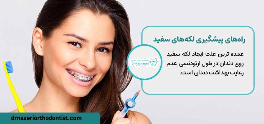 علت ایجاد لکه سفید روی دندان در طول ارتودنسی