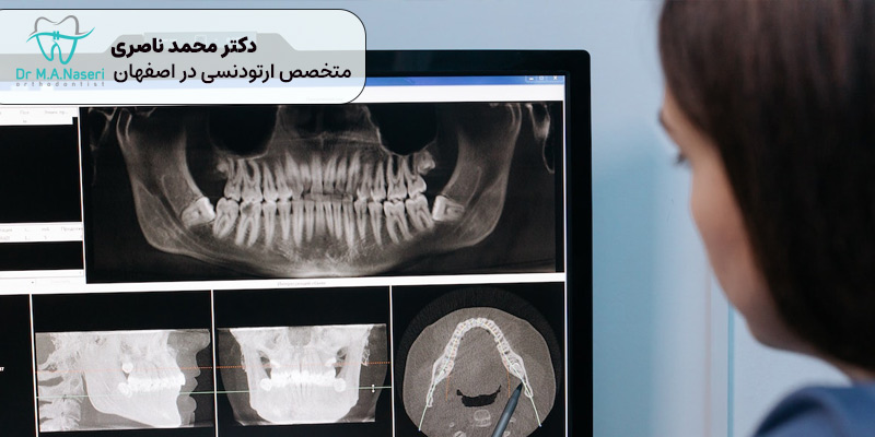 آیا اشعه ایکس ارتودنسی خطرناک است؟