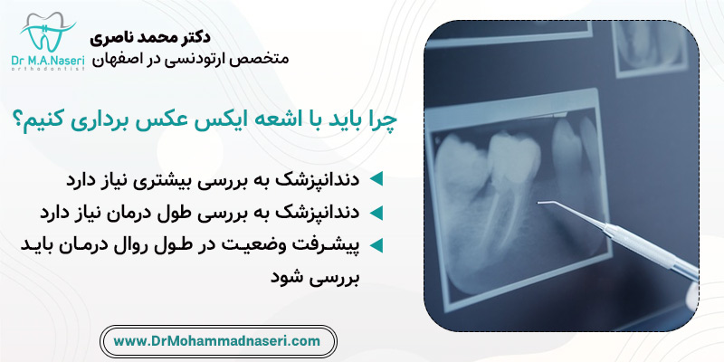 دلیل عکس برداری با اشعه ایکس از دندان