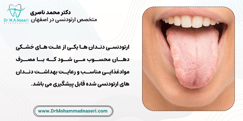 ارتودنسی باعث خشکی دهان می شود