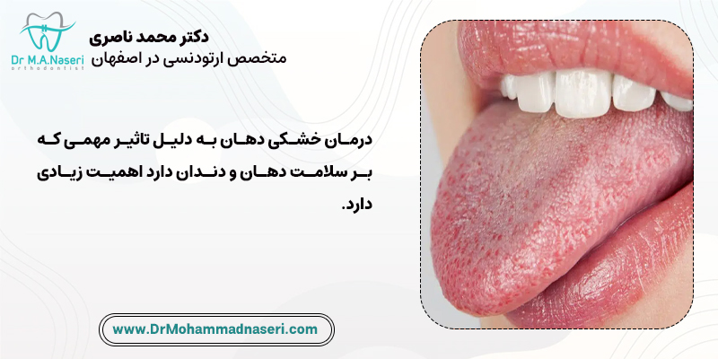 درمان خشکی دهان تاثیر مهمی بر سلامت دهان و دندان دارد.