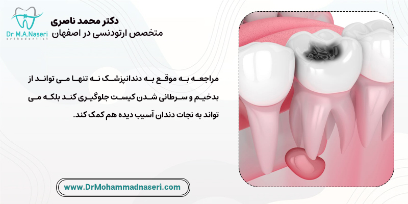 اهمیت مراجعه به موقع به دندانپزشک برای درمان کیست دندان