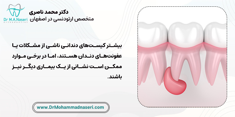 علت ایجاد کیست دندان