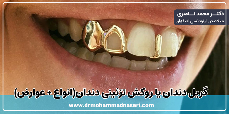 گریل دندان یا روکش تزئینی دندان(انواع + عوارض)